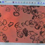 platelet alumina